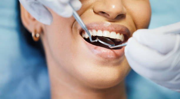 Best Urgent Care for Lost Fillings or Crowns in Enosburg Falls, VT